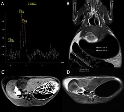 Proton Magnetic Resonance Spectroscopy at 3.0T in Rabbit With VX2 Liver Cancer: Diagnostic Efficacy and Correlations With Tumor Size